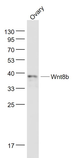 Wnt8b Rabbit pAb(bs-6245R)-50u