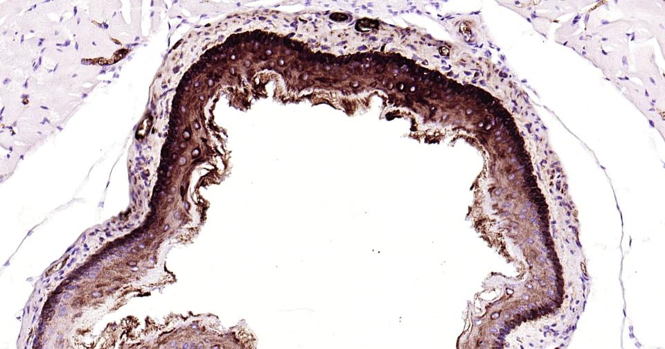 Cytokeratin 14 Recombinant Rab