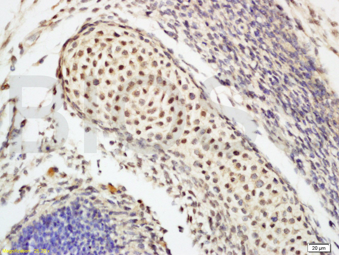 Oct-3/Oct-4 Rabbit pAb(bs-1111