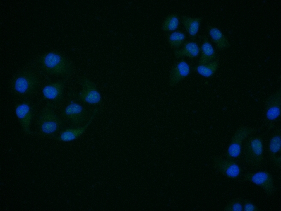 CREM Rabbit pAb(bs-5135R)-50ul