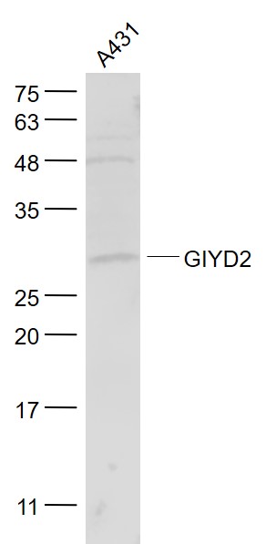 GIYD2 Rabbit pAb(bs-13361R)-50