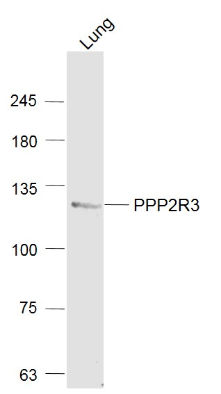 PPP2R3 Rabbit pAb(bs-5759R)-50