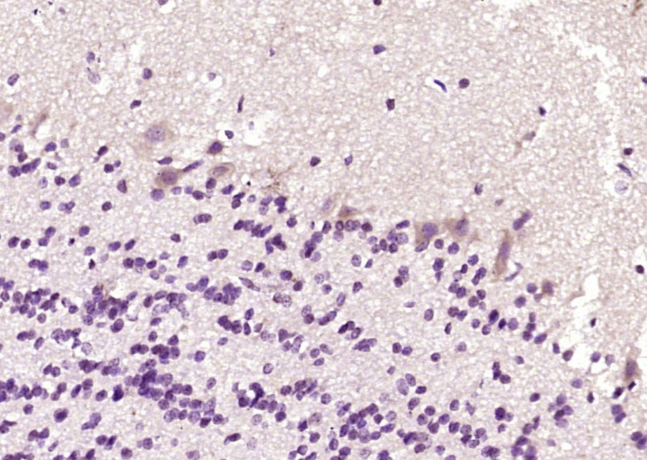 Phospholipase C beta 1 Rabbit 