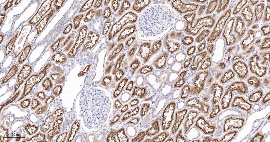 Cubilin Recombinant Rabbit mAb