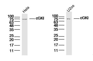 cGKI Rabbit pAb(bs-6705R)-50ul