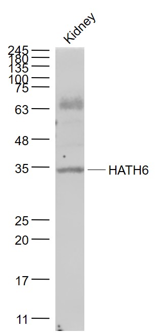 HATH6/Protein atonal homolog 8