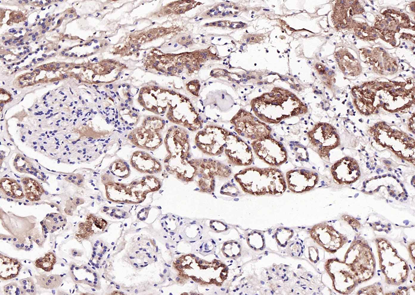 RBP4 Mouse mAb(bsm-43011M)-50u