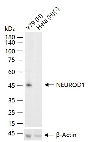 NEUROD1 Recombinant Rabbit mAb