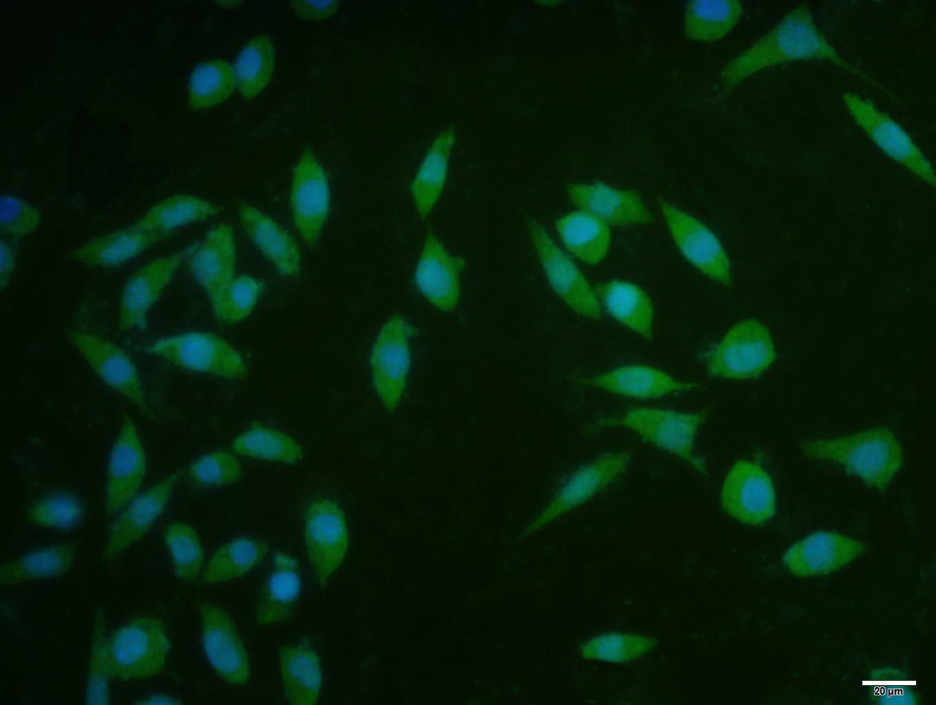 Cyclin D1 Rabbit pAb(bs-20596R