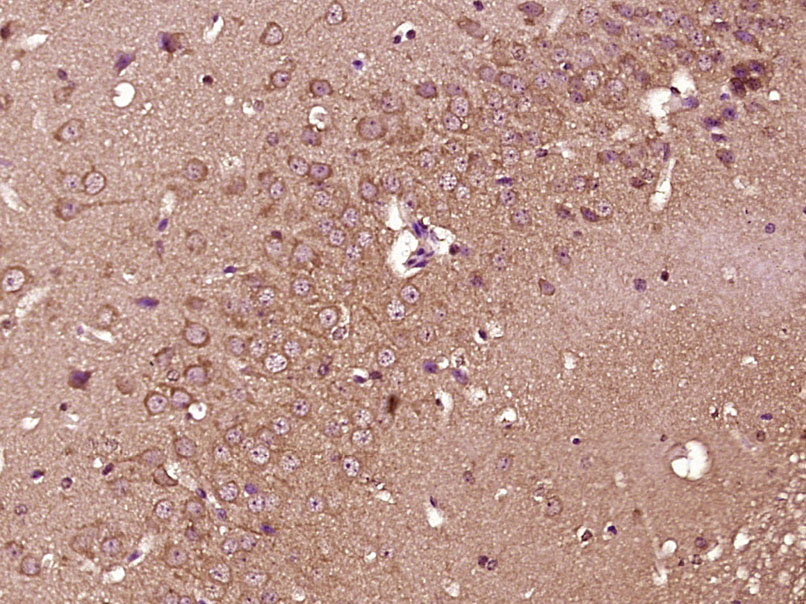 SLC36A2 Rabbit pAb(bs-21271R)-