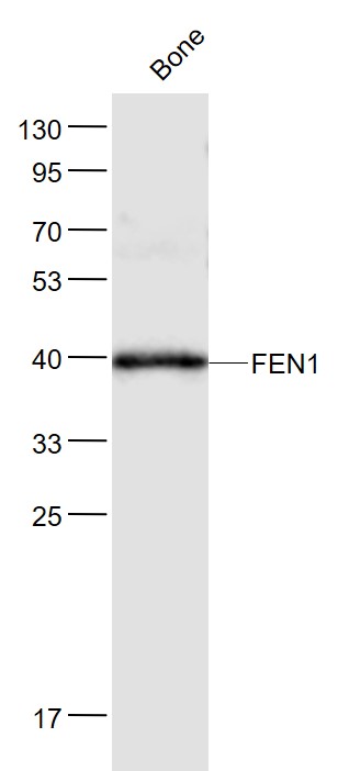 FEN1 Rabbit pAb(bs-9876R)-50ul