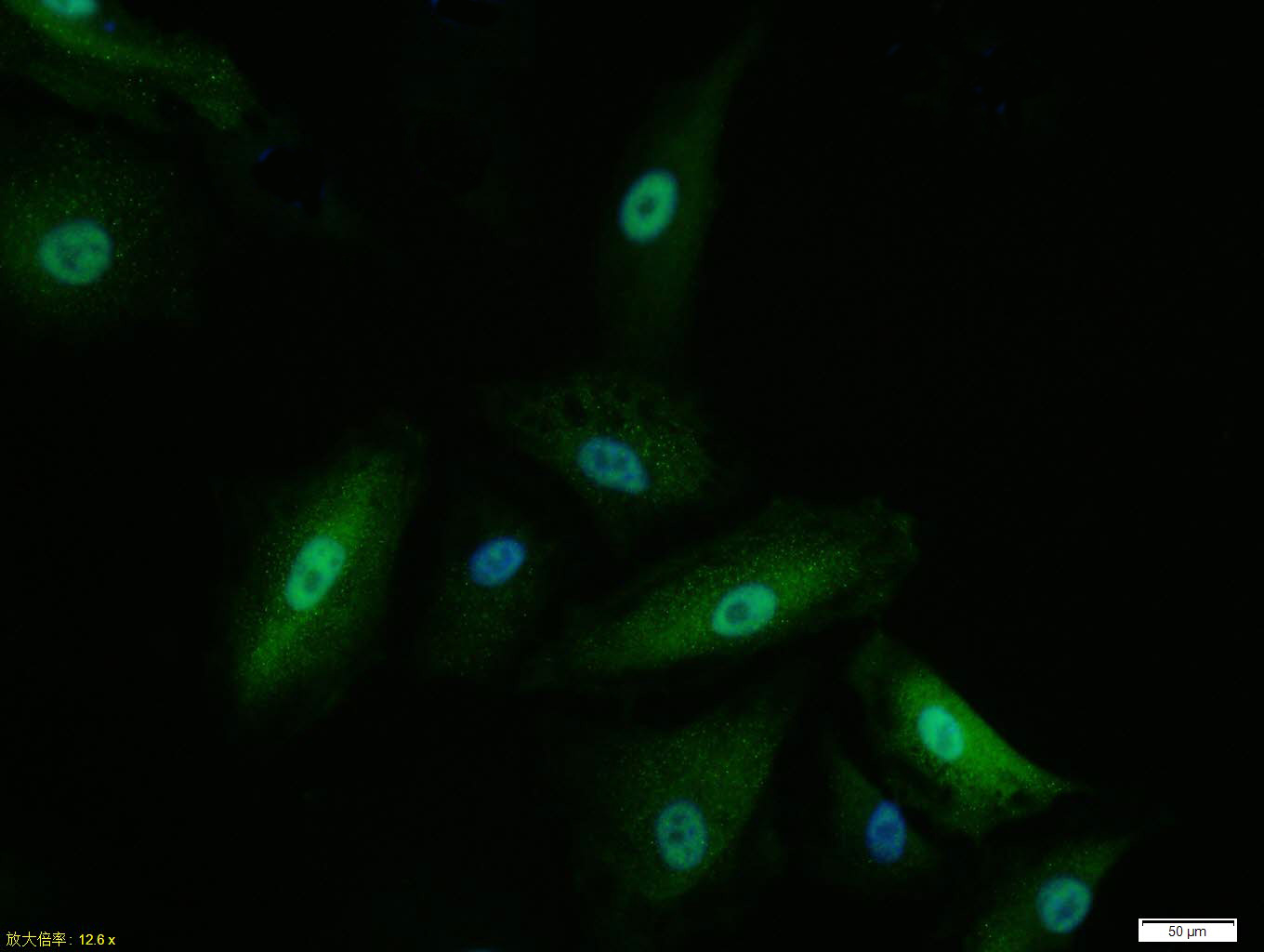 Mad2L1 Recombinant Rabbit mAb(