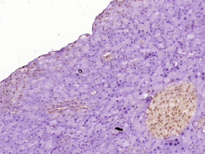 PRKCBP1 Rabbit pAb(bs-19178R)-