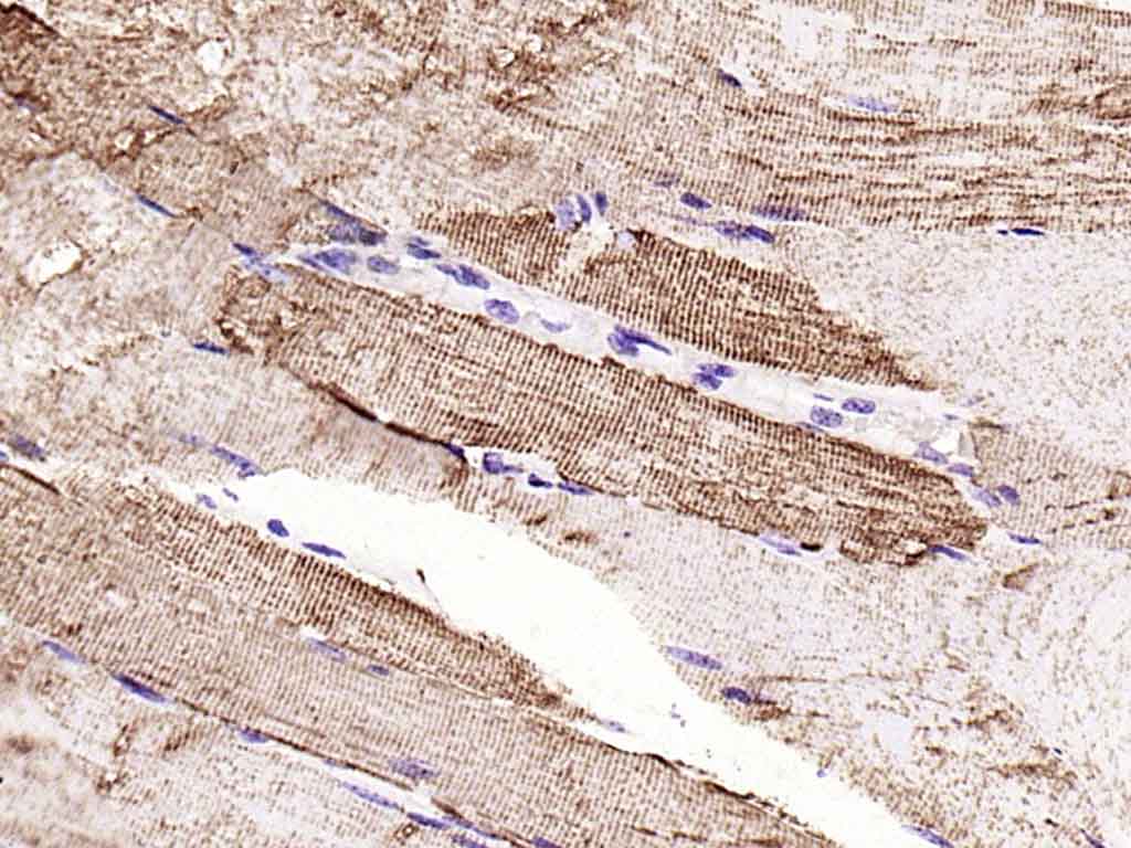 VDAC1 Recombinant Rabbit mAb, 
