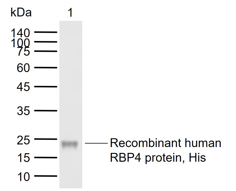 RBP4 Mouse mAb(bsm-43011M)-50u