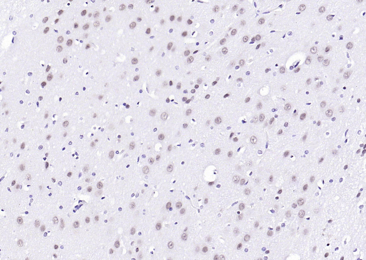 ErbB4 Rabbit pAb(bs-10226R)-50