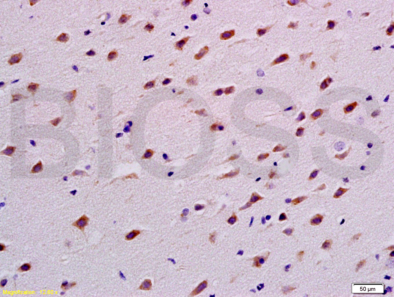 TUBB3 (Neuronal Marker) Rabbit