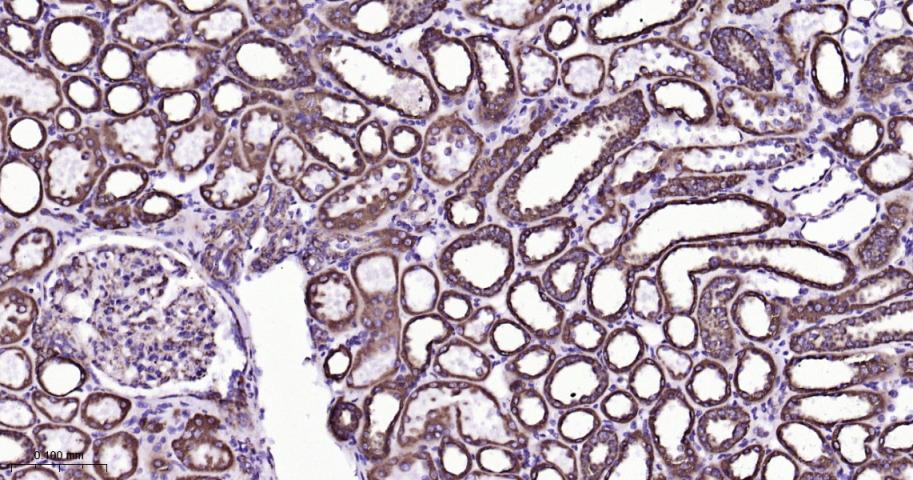 VDAC1 Recombinant Rabbit mAb, 