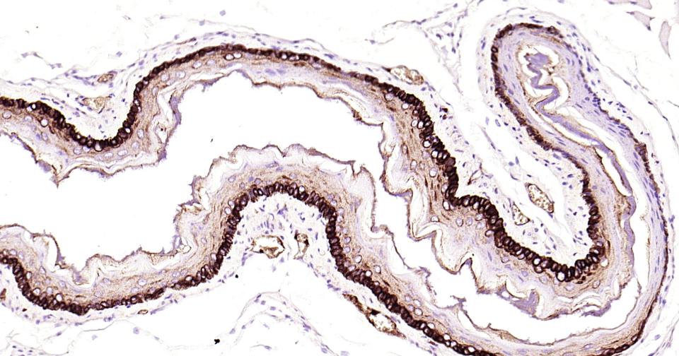 Cytokeratin 14 Recombinant Rab