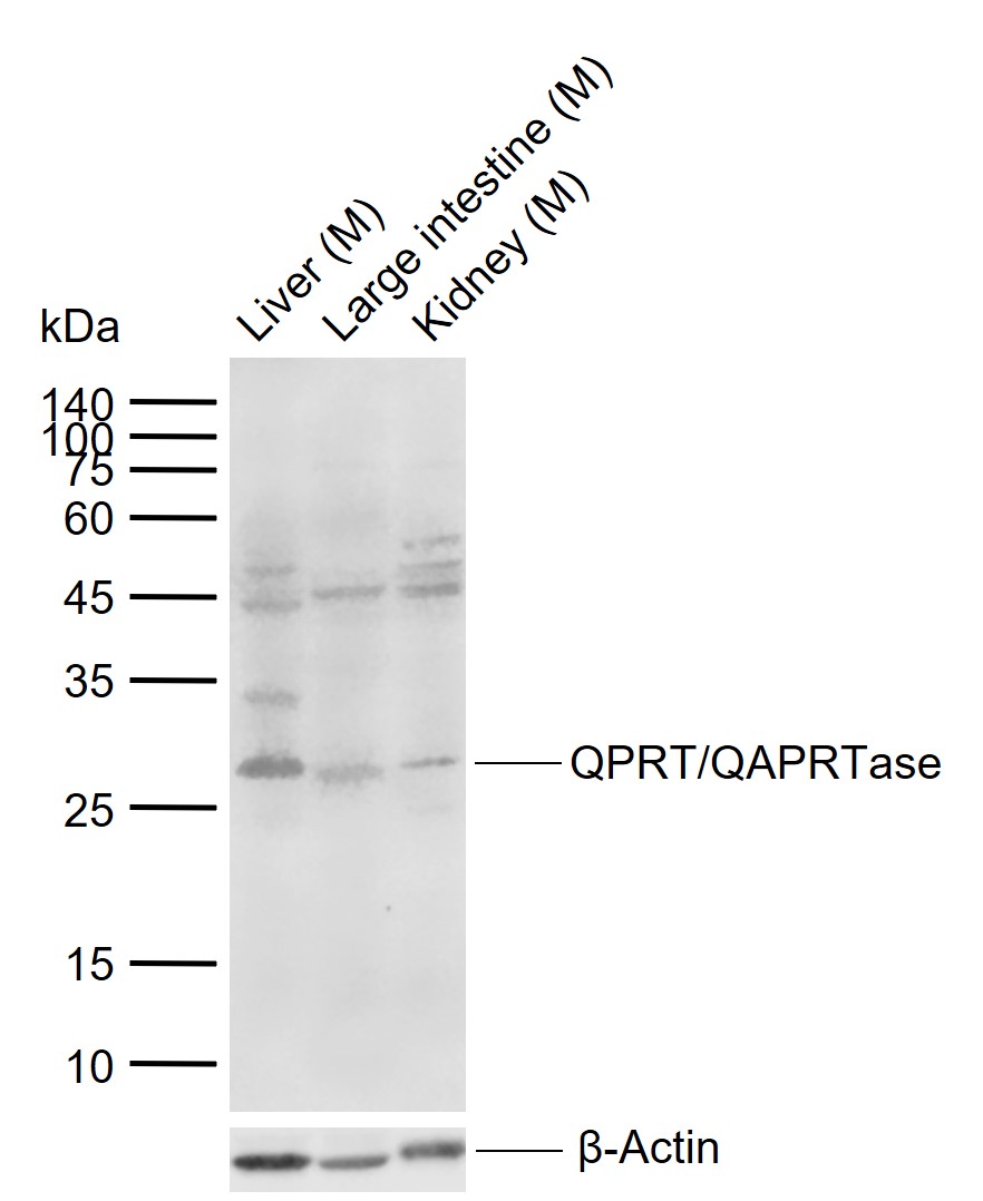 QPRT/QAPRTase Rabbit pAb(bs-20