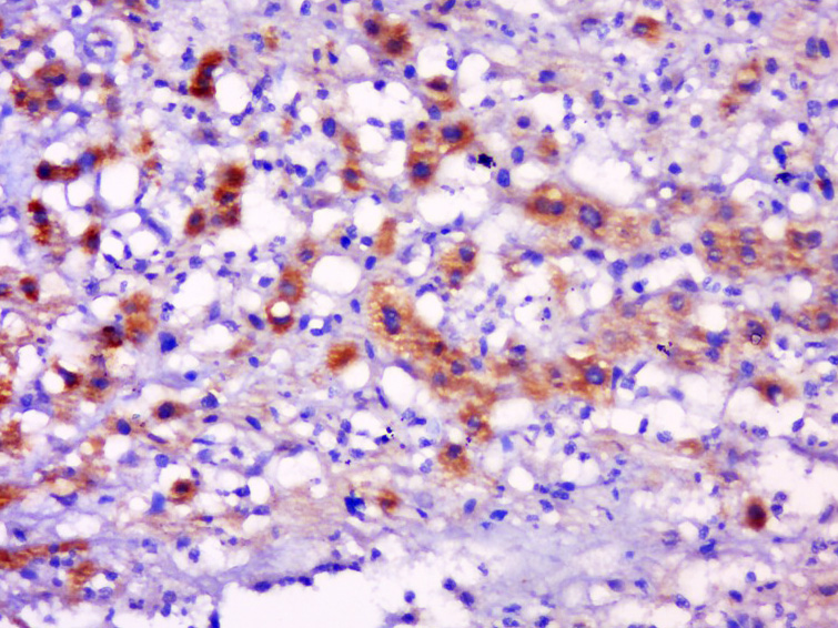Tryptase delta Rabbit pAb(bs-2