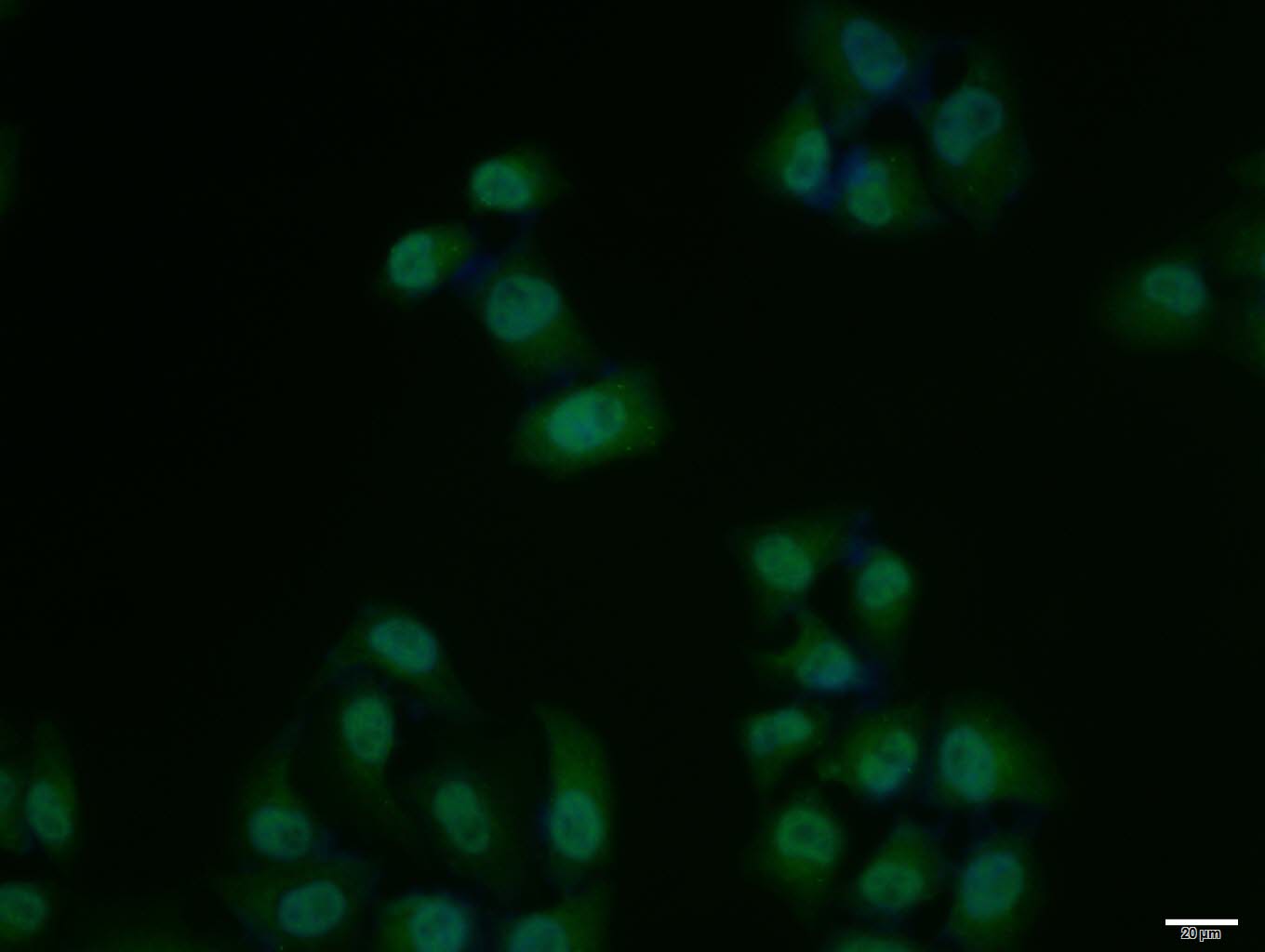 phospho-KLF5 (Ser311) Rabbit p