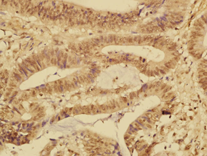 FABP12 Rabbit pAb(bs-13064R)-5