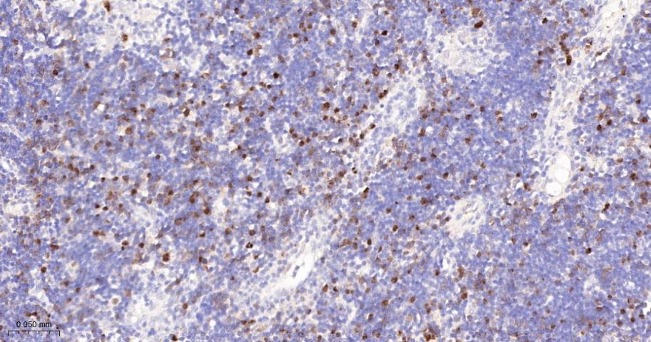 CCNA2 Recombinant Rabbit mAb(b