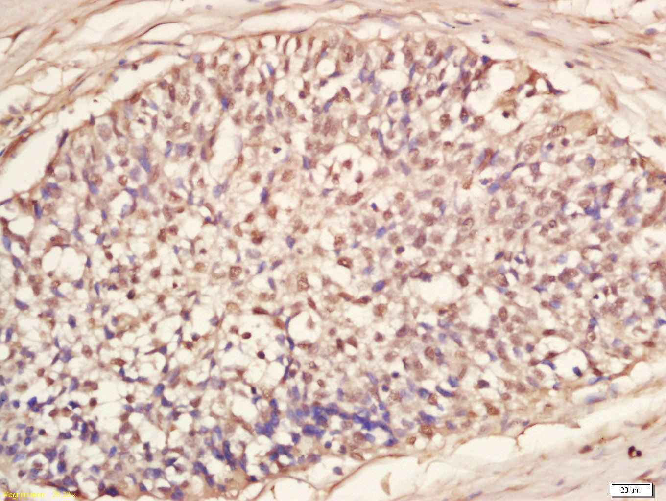 RNA polymerase II CTD repeat Y