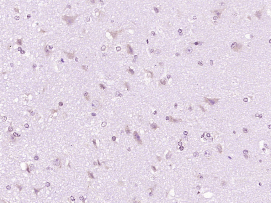 phospho-PDGFRA (Tyr849) / PDGF