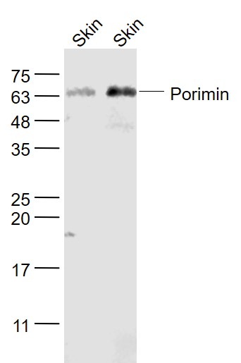 Porimin Rabbit pAb(bs-7674R)-5