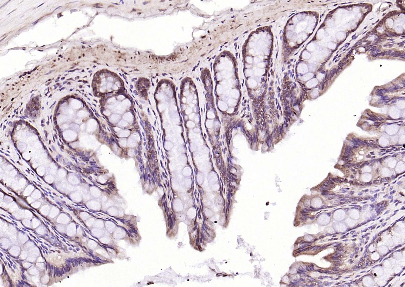 CREM Rabbit pAb(bs-5135R)-50ul