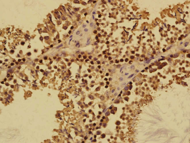 FABP12 Rabbit pAb(bs-13064R)-5