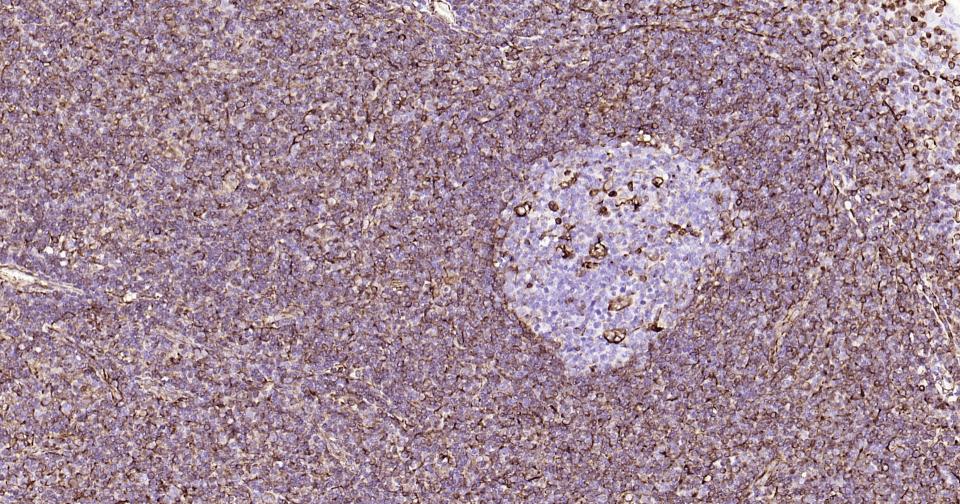 Vimentin Mouse mAb(bsm-33170M)