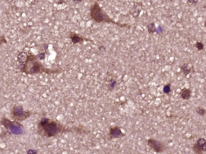 phospho-PFKFB3/PFK2 (Ser467) R