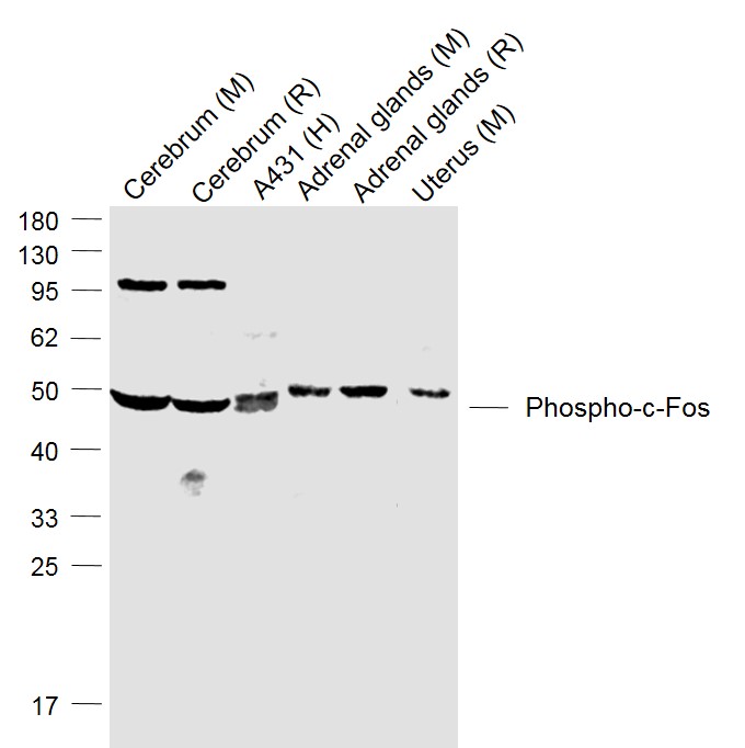 phospho-c-Fos (Ser362) Rabbit