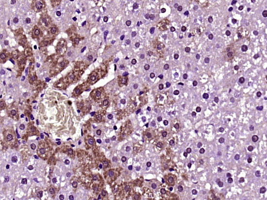 Presenilin 1 + 2 Rabbit pAb(bs