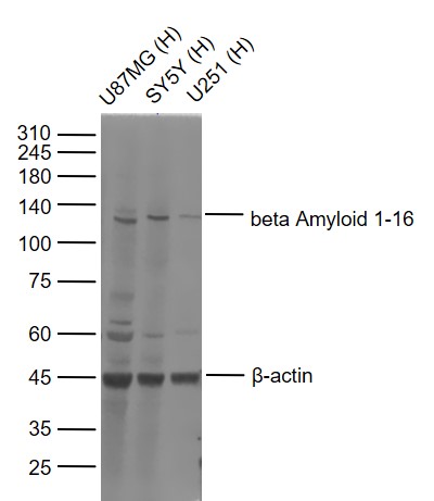 beta Amyloid 1-16 Mouse pAb(bs