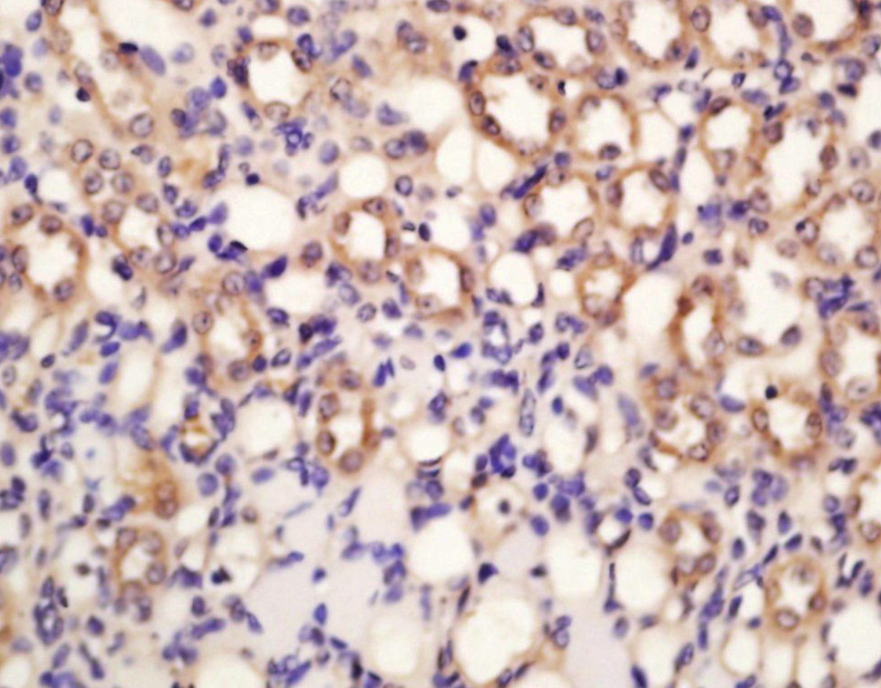 SOD1 Rabbit pAb(bs-10216R)-50u