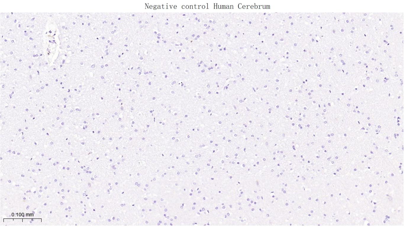 CD79a Mouse mAb(bsm-33449M)-50