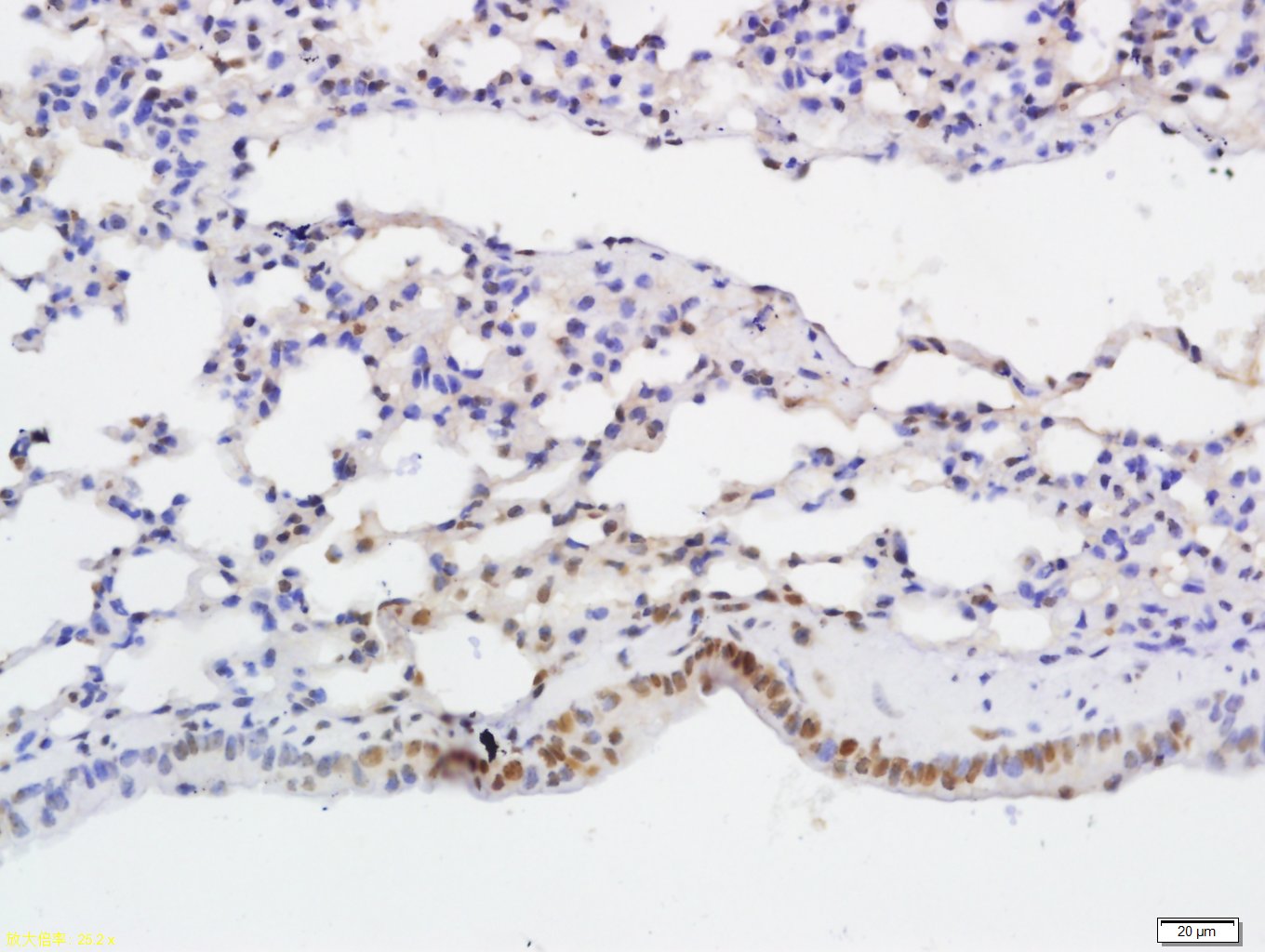 NFKB p65 (Acetyl-Lys314/Lys315