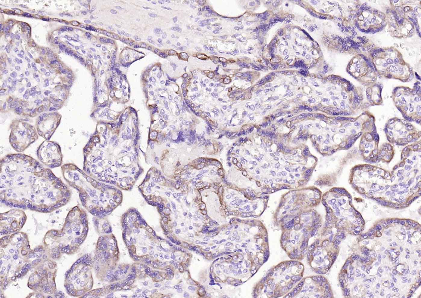 ACVRL1 Rabbit pAb(bs-6020R)-50