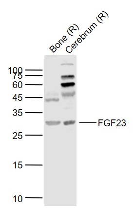 FGF23 Rabbit pAb(bs-5768R)-50u