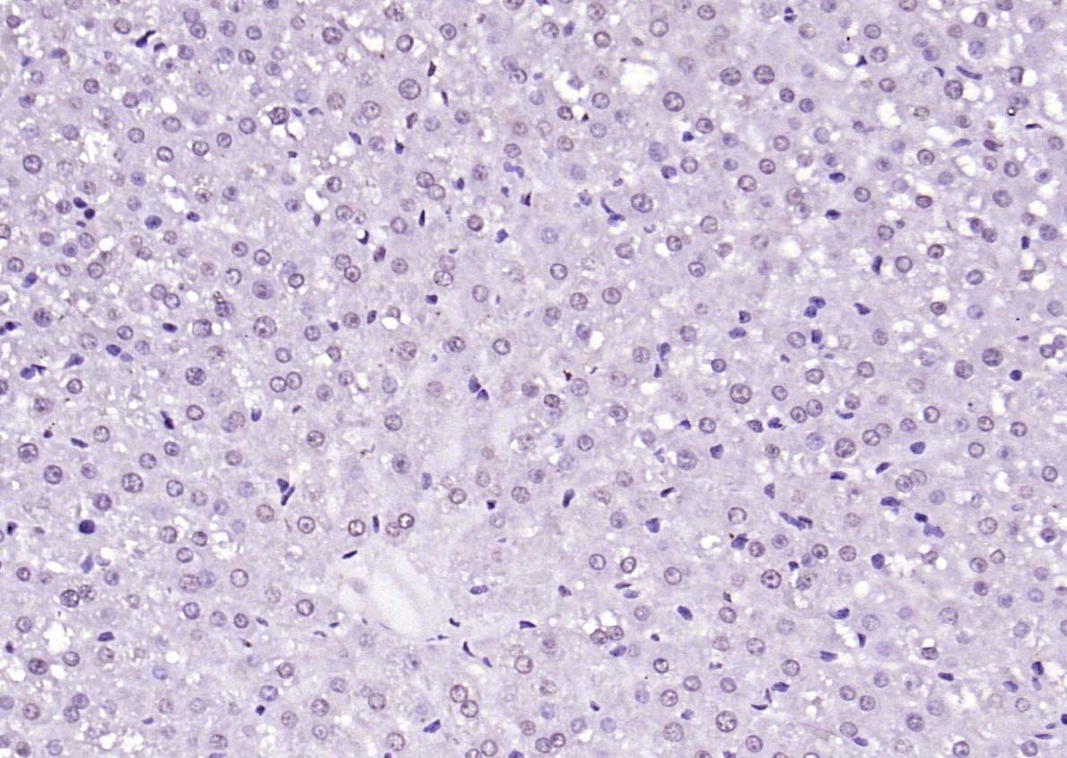 SIK1 Rabbit pAb(bs-6252R)-50ul