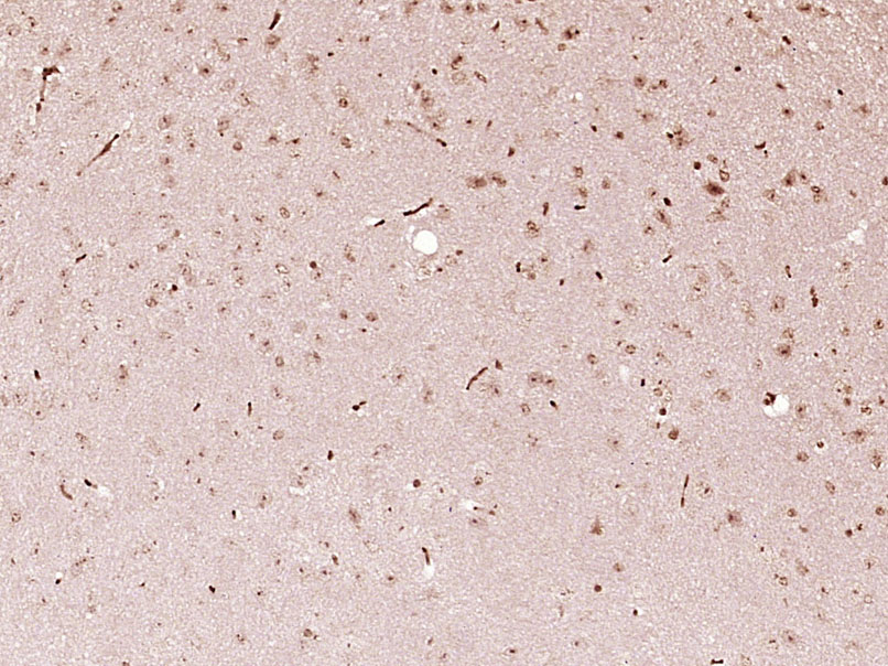 FOXJ3 Rabbit pAb(bs-16167R)-50