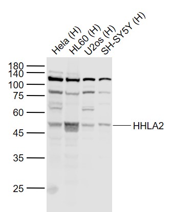 HHLA2 Rabbit pAb(bs-23898R)-50