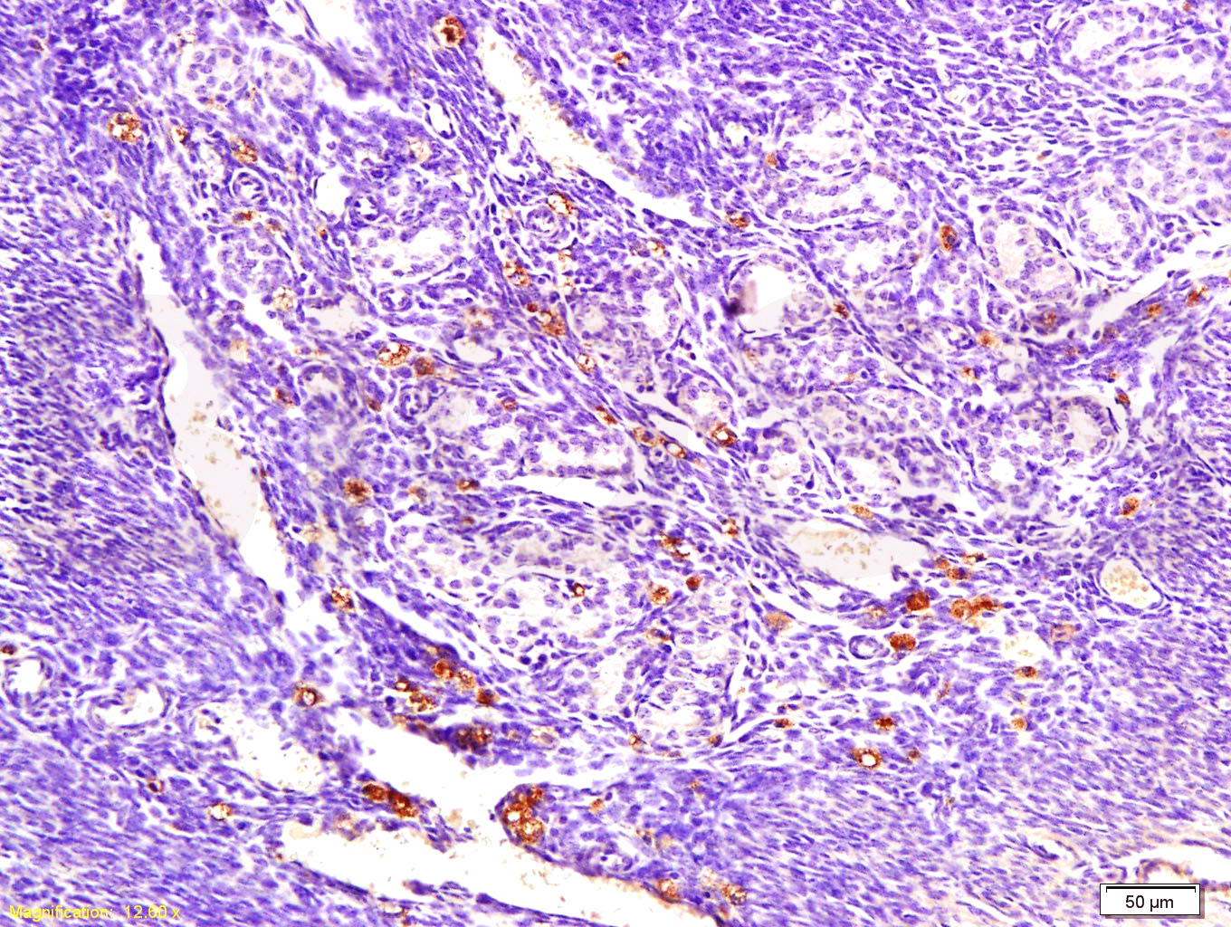 ECM1 Rabbit pAb(bs-0776R)-50ul