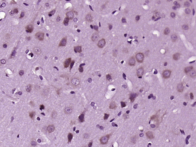 MARK2 Rabbit pAb(bs-5741R)-50u