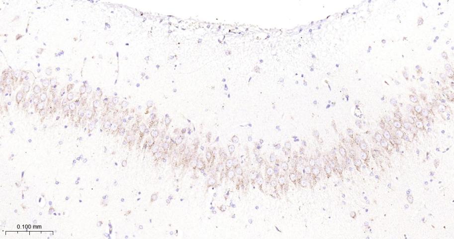 GBA Recombinant Rabbit mAb(bsm