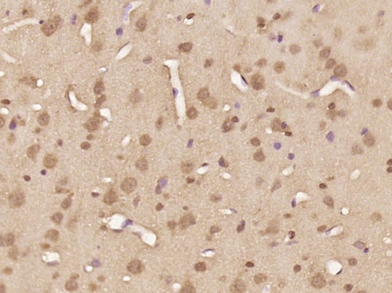 phospho-FOXO4 (Thr451) Rabbit 